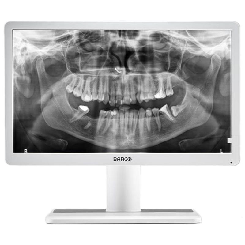 Медицинский монитор Barco Eonis 22′ (MDRC-2222 Option WP) Dental